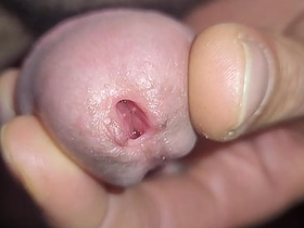 Rhetoric catachresis techniques - Frenulum fun korean gay porn movies