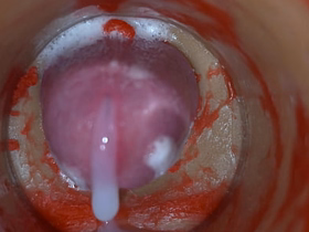 Insemination - Internal Camera Captures Abyss Male Ejaculation gay porn japan scat