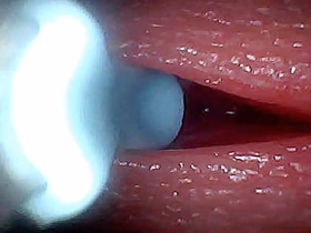 I couldn’t believe what happens INSIDE the penis as A sperm passes through (endoscopic footage) hot gay porn roger